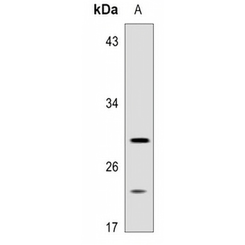 ACER3 Rabbit Polyclonal Antibody