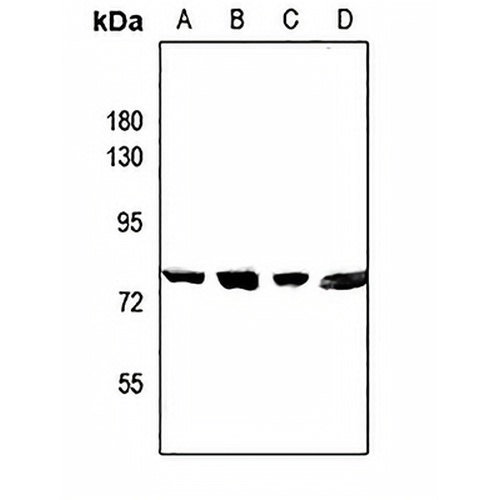 CEP78 Rabbit Polyclonal Antibody