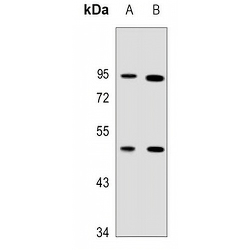 TUFM Rabbit Polyclonal Antibody