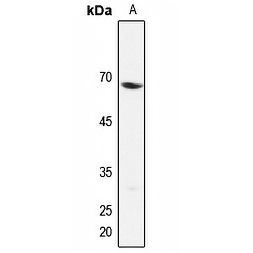 EIF3D Rabbit Polyclonal Antibody