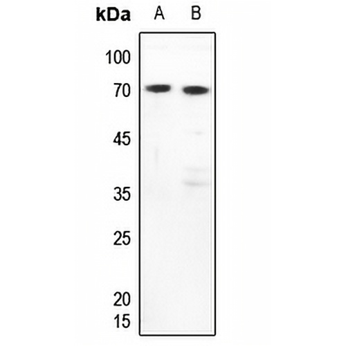 FUBP3 Rabbit Polyclonal Antibody