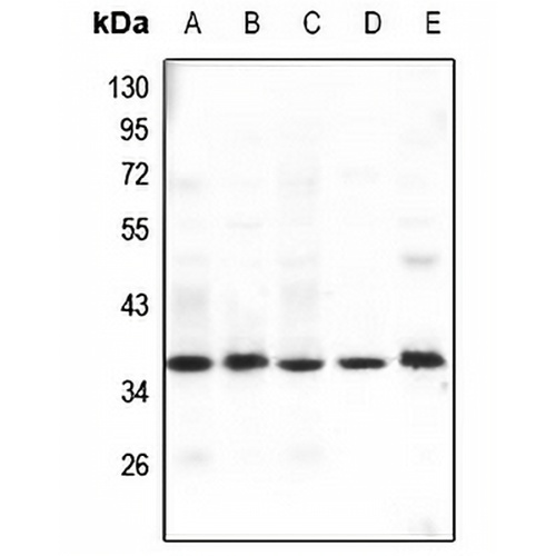 GHITM Rabbit Polyclonal Antibody