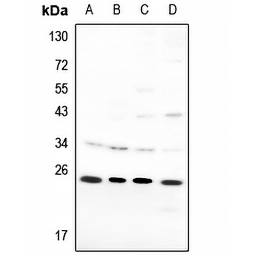 SAR1B Rabbit Polyclonal Antibody