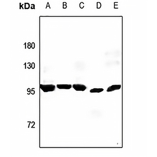 LONP2 Rabbit Polyclonal Antibody