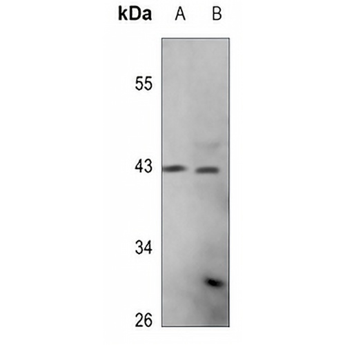 PEX10 Rabbit Polyclonal Antibody