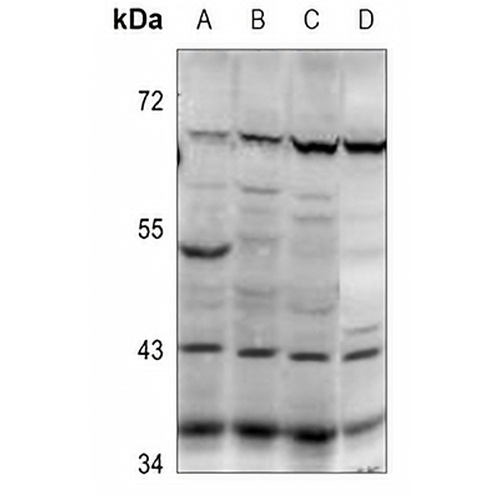 PABPC5 Rabbit Polyclonal Antibody