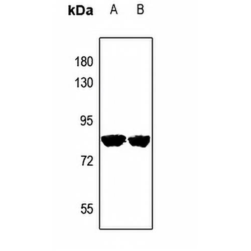 PRPF39 Rabbit Polyclonal Antibody