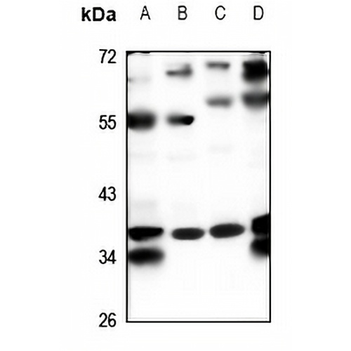 PPM1K Rabbit Polyclonal Antibody