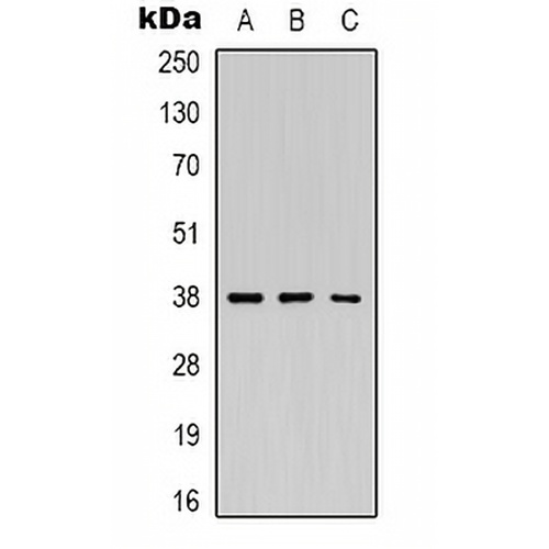 Renin Rabbit Polyclonal Antibody