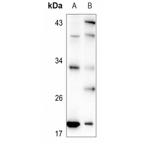 TCEAL1 Rabbit Polyclonal Antibody