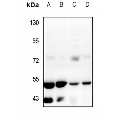 ZFYVE19 Rabbit Polyclonal Antibody