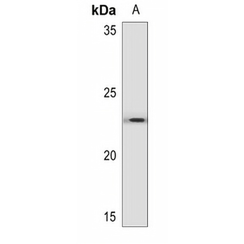 BNIP3 Rabbit Polyclonal Antibody