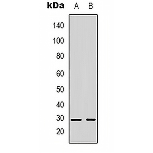 Kallikrein 3 Rabbit Polyclonal Antibody