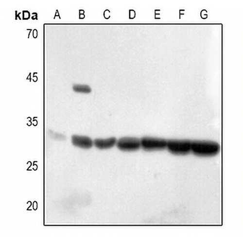 ECI1 Rabbit Polyclonal Antibody