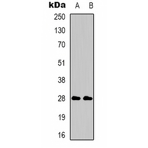 CD58 Rabbit Polyclonal Antibody