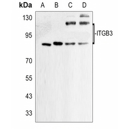 CD61 Rabbit Polyclonal Antibody