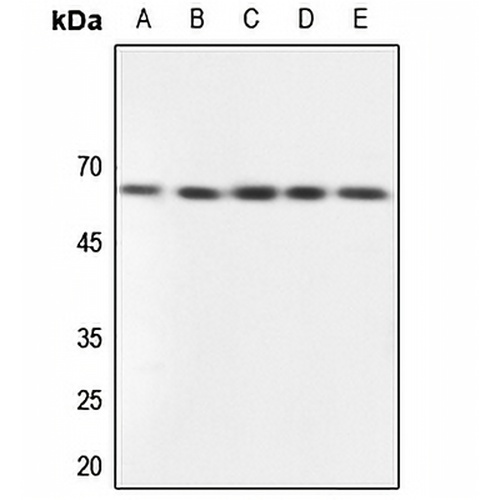 GPCR135 Rabbit Polyclonal Antibody