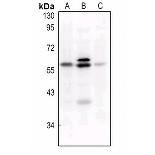 c-FOS (Phospho-S32) Rabbit Polyclonal Antibody