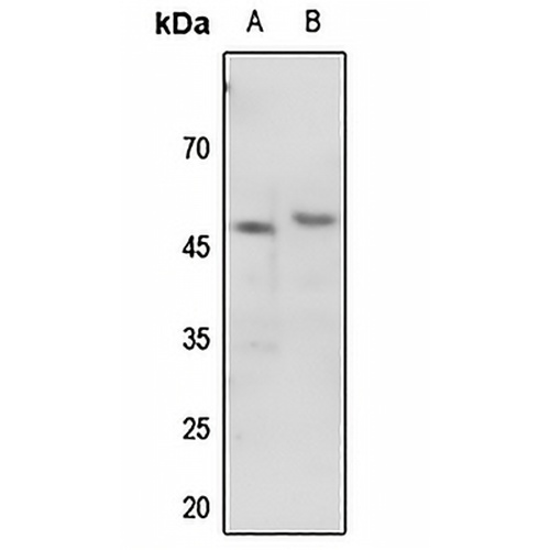 p47 phox (Phospho-S345) Rabbit Polyclonal Antibody