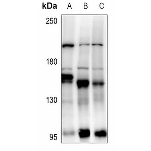 ABL1 Rabbit Polyclonal Antibody