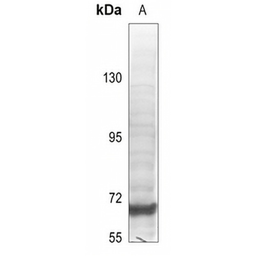 SPHK2 Rabbit Polyclonal Antibody