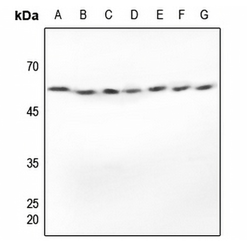Alpha-tubulin Rabbit Polyclonal Antibody
