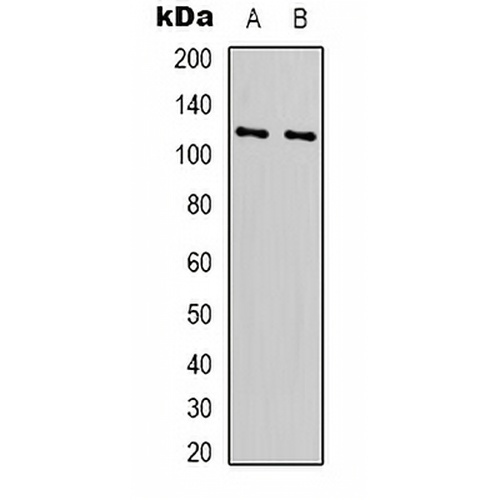 RPS6KC1 Rabbit Polyclonal Antibody