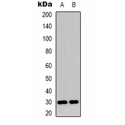 MMTAG2 Rabbit Polyclonal Antibody