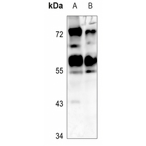 CADM1 Rabbit Polyclonal Antibody
