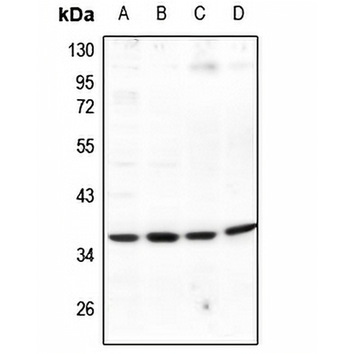 EIF3J Rabbit Polyclonal Antibody