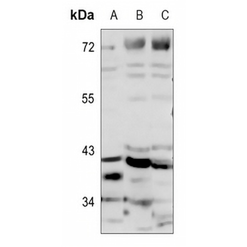 MRPS22 Rabbit Polyclonal Antibody