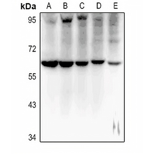 MT-ND5 Rabbit Polyclonal Antibody