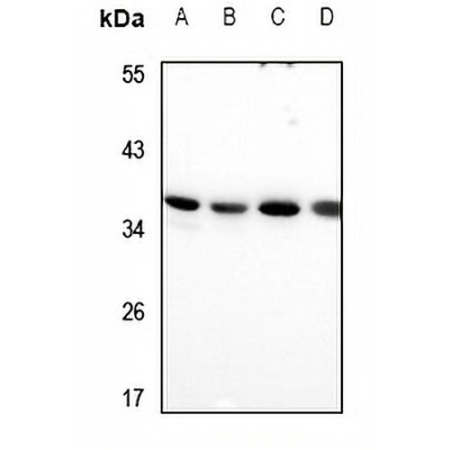RIMS4 Rabbit Polyclonal Antibody