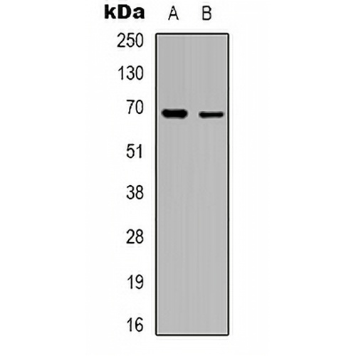 RhoBTB3 Rabbit Polyclonal Antibody