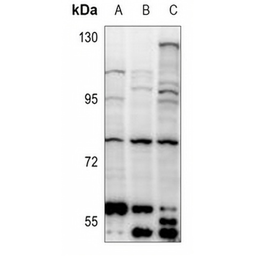 NRBP1 Rabbit Polyclonal Antibody