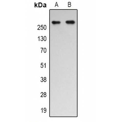 p300 (Acetyl-K1542) Rabbit Polyclonal Antibody