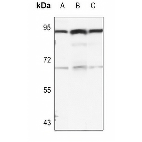 B-RAF (Phospho-S446) Rabbit Polyclonal Antibody
