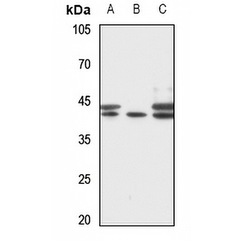 RRS1 Rabbit Polyclonal Antibody