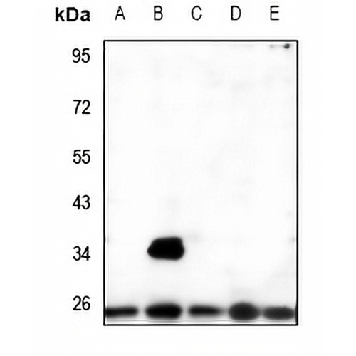 MRRF Rabbit Polyclonal Antibody