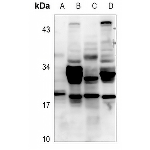 GAS3 Rabbit Polyclonal Antibody