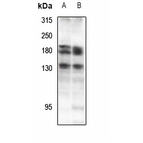 DZIP3 Rabbit Polyclonal Antibody