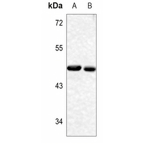 YBX1 (Phospho-S102) Rabbit Polyclonal Antibody