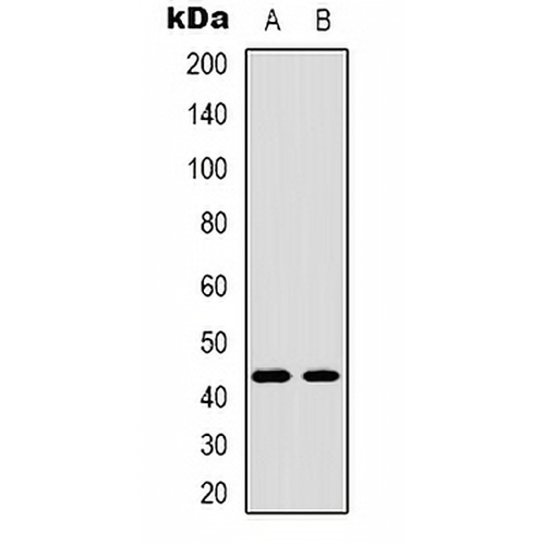 TBX1 Rabbit Polyclonal Antibody