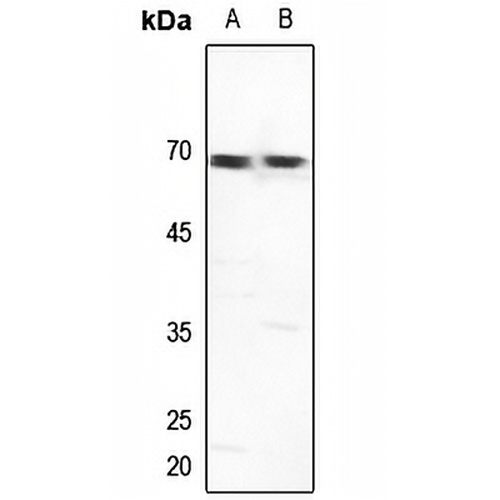 GTF2H1 Rabbit Polyclonal Antibody