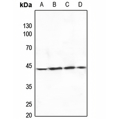 MKK4 Rabbit Polyclonal Antibody