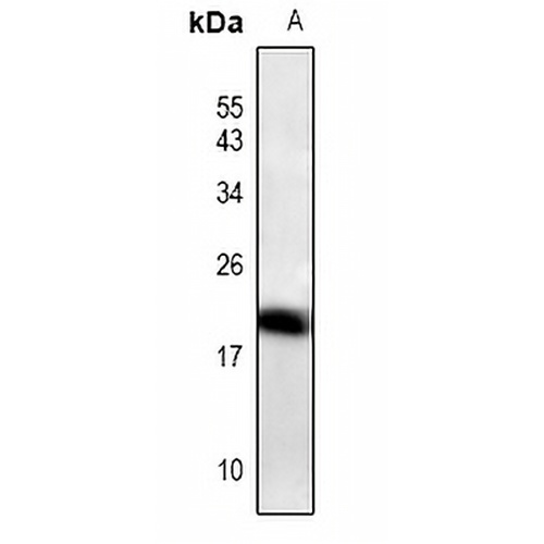 ID4 Rabbit Polyclonal Antibody