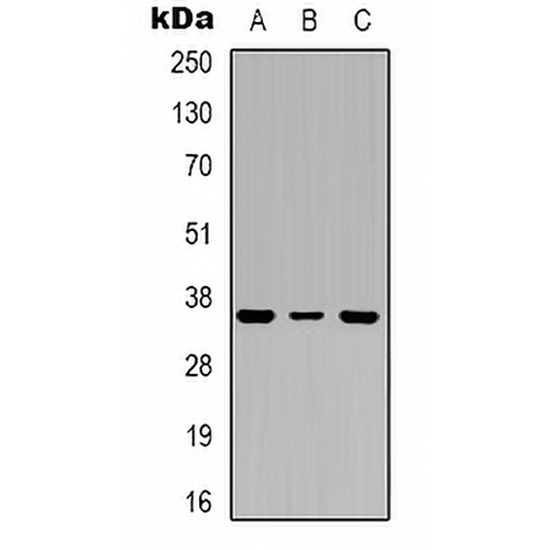 PIG3 Rabbit Polyclonal Antibody