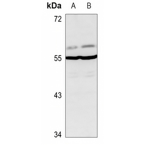Glycerate Kinase Rabbit Polyclonal Antibody