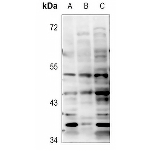 BTBD6 Rabbit Polyclonal Antibody