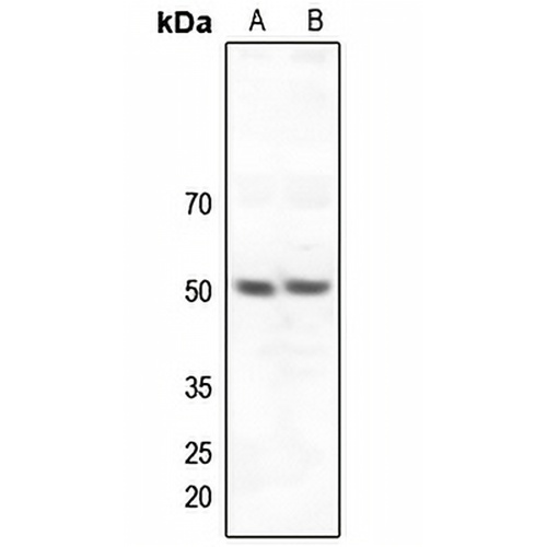 ZNF436 Rabbit Polyclonal Antibody